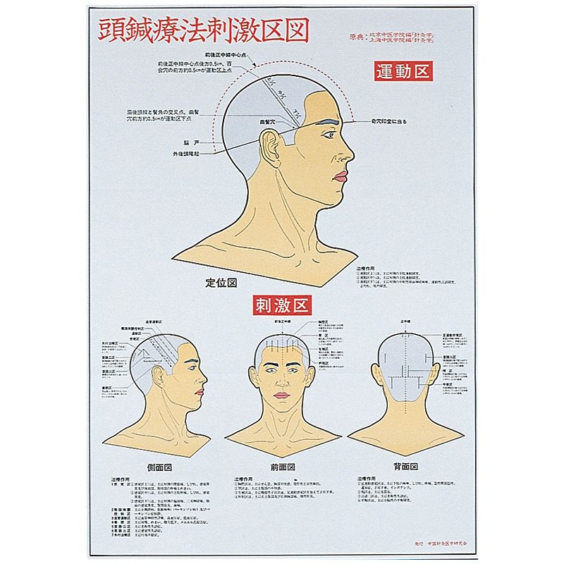 頭鍼療法刺激区図　ポスター　71×51.5cm